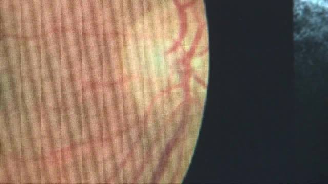Search For A Location Acuity Eye Group